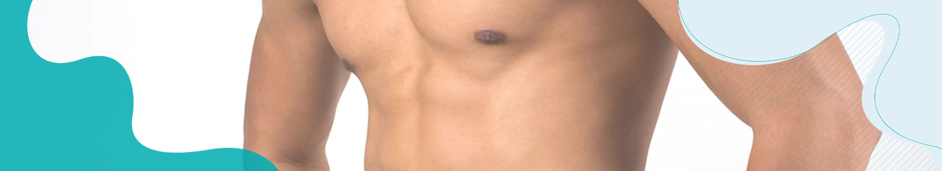 Gynaecomastia